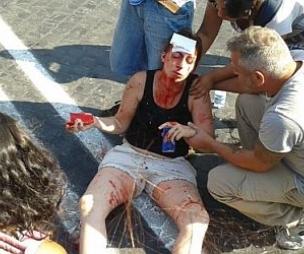 manifestante ferita roma